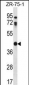 CTSO Antibody (N-term)